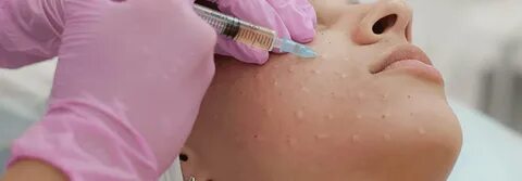 Мезотерапия сколько нужно процедур для лица