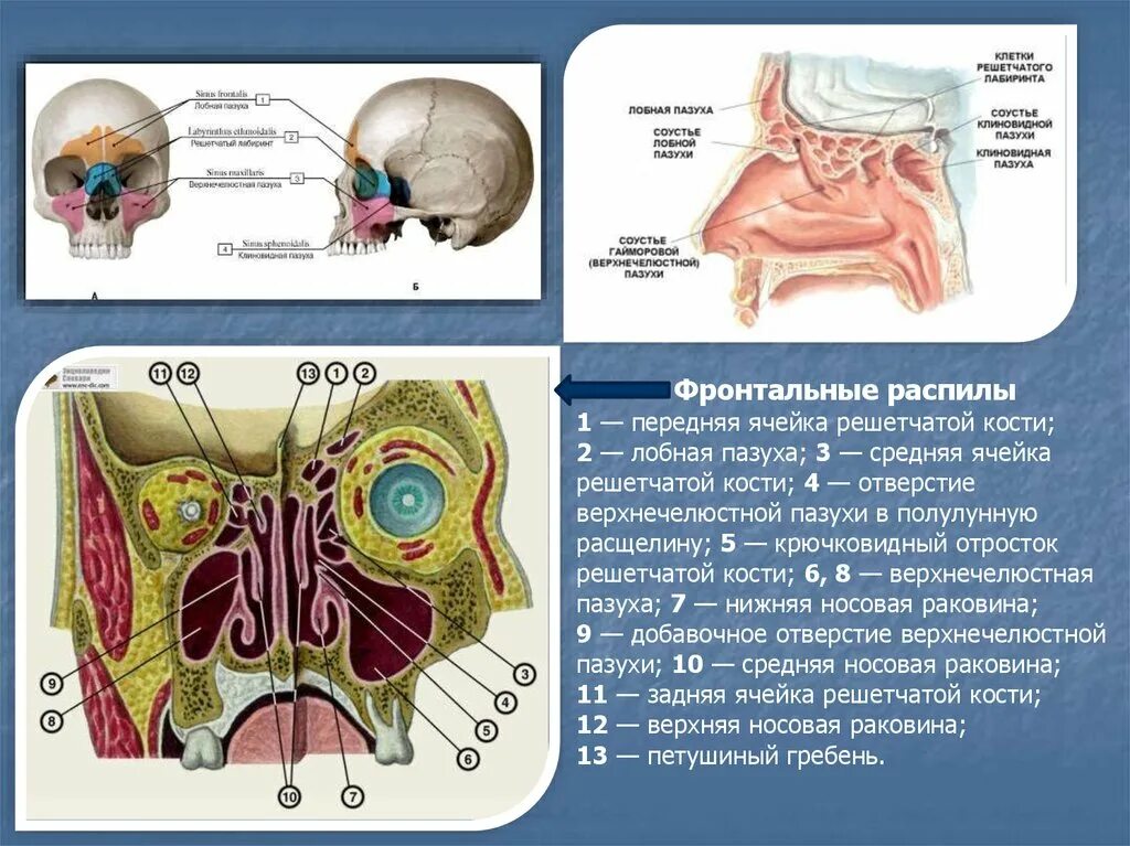 Задние ячейки решетчатой кости анатомия. Решетчатая кость решетчатый Лабиринт. Стенки лобной пазухи анатомия. Решетчатый Лабиринт решетчатой кости анатомия. Утолщение слизистой оболочки решетчатых лабиринтов