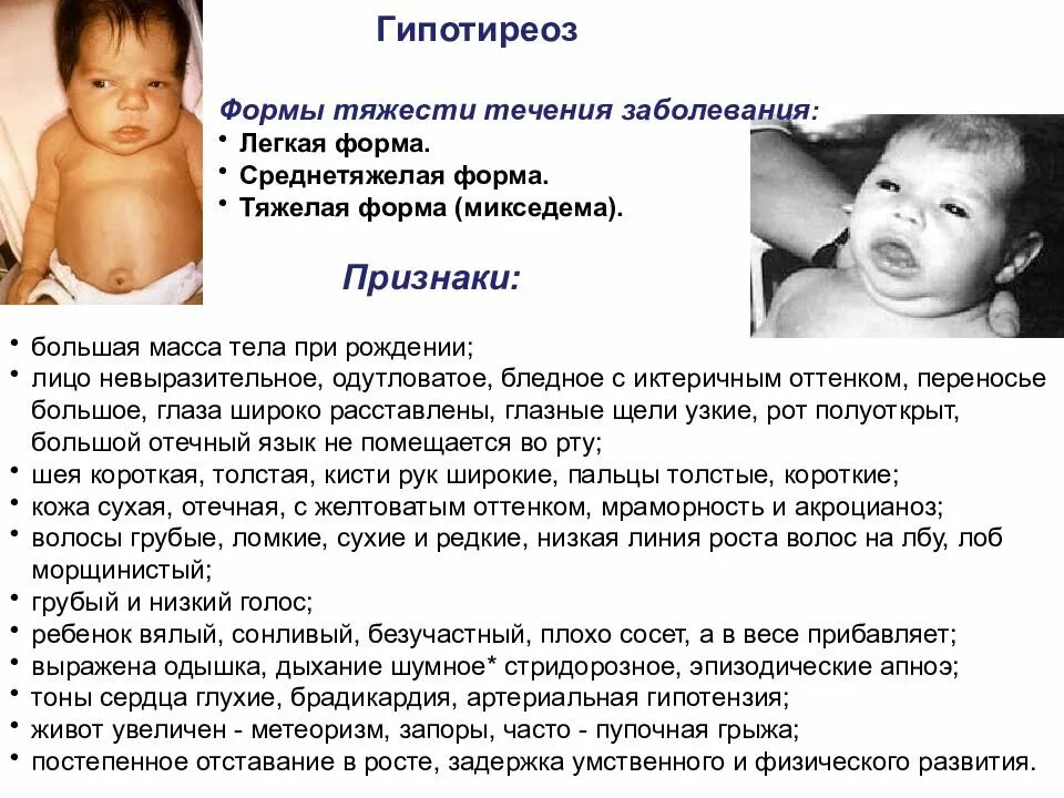 Диагноз ребенка при рождении