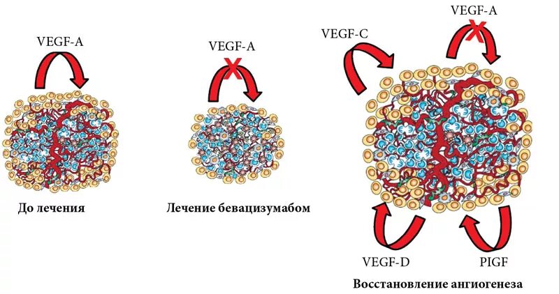 Anti VEGF препараты в офтальмологии. Ингибиторы ангиогенеза в офтальмологии препараты. Ингибиторы VEGF В онкологии. Блокаторы VEGF. Ингибиторы рака