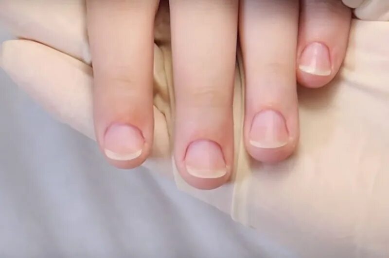 Трапециевидная форма ногтей. Исправление трапециевидной формы ногтей. Как правильно подобрать форму ногтей. Трапециевидные ногти какую форму. Форма для широких ногтей.