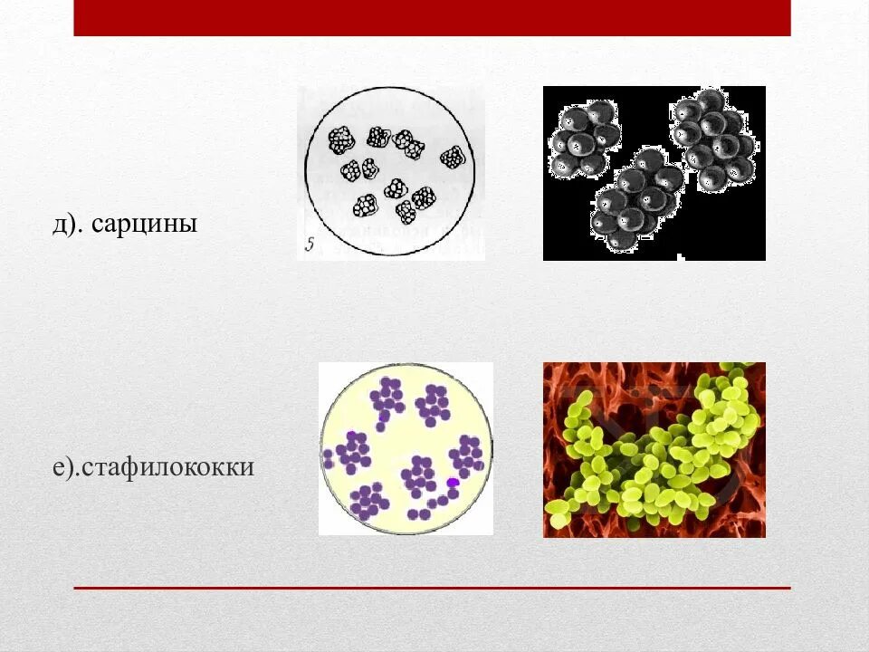 Сарцины и стафилококки. Сарцины заболевания. Сарцины рисунок. Сарцины примеры бактерий.