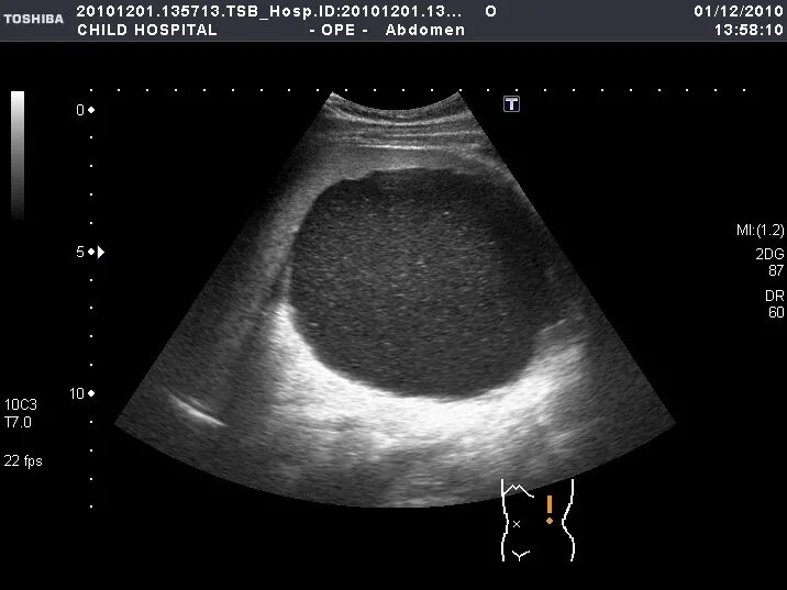 узи брюшной полости образование