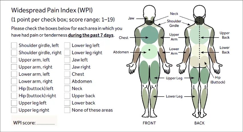 None index 0. Wpi фибромиалгия. фибромиалгия индекс. widespread pain index. критерии диагностики фибромиалгии.