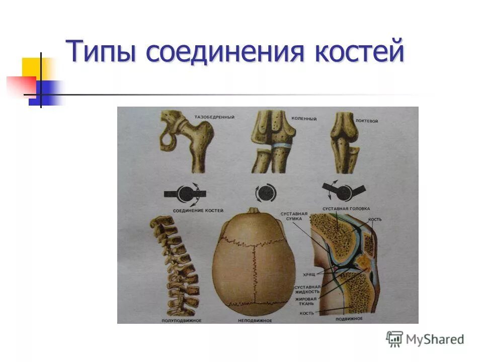 Тип соединение бедренной кости