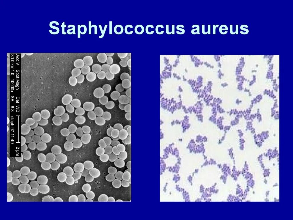 S. aureus золотистый стафилококк. Стафилококки генцианвиолет. Золотистый стафилококк микроскопия. Золотистый стафилококк микробиология препарат. Staphylococcus aureus 4