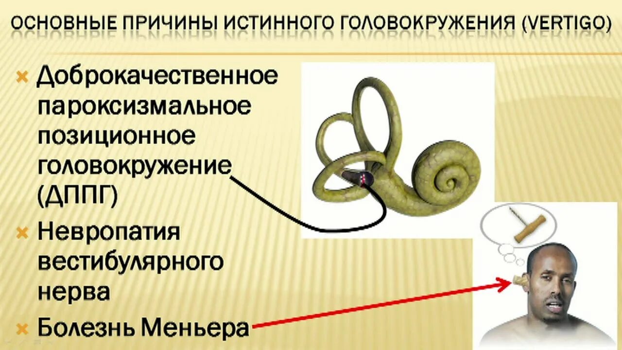 Дппг что это за болезнь. ДППГ. Позиционное головокружение причины. Доброкачественное пароксизмальное позиционное головокружение. ДППГ доброкачественное пароксизмальное.