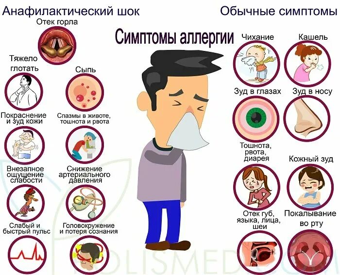 Симптоматика аллергии.