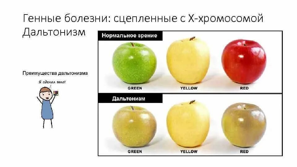 Генотип человека с дальтонизмом. Генные заболевания дальтонизм. Дальтонизм это генная болезнь. Наследование дальтонизма. Дальтонизм генетика.