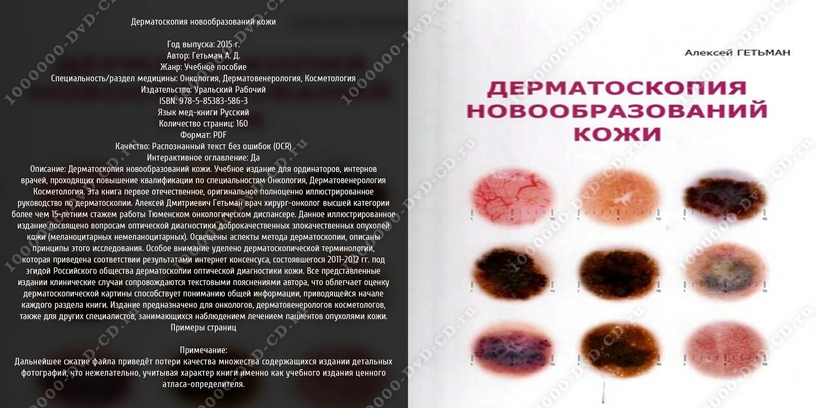 дерматоскопия книги купить. атлас дерматоскопии. дерматоскопия новообразований гетьман. атлас по дерматоскопии потекаев. атлас по дерматоскопии.