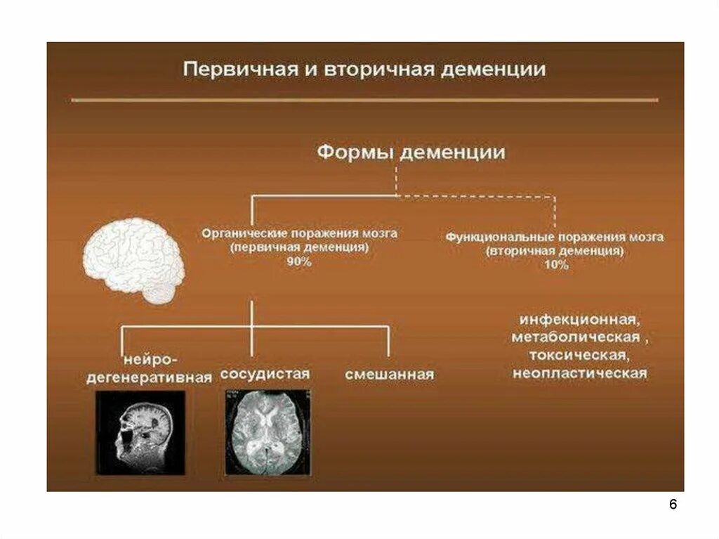 Формы слабоумия. Классификация деменций клинические формы. Формы деменции. Деменция классификация.