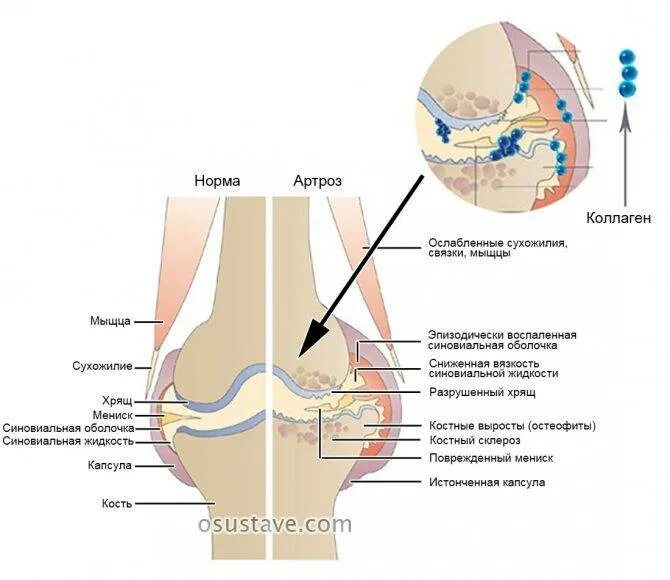 Коллаген польза для суставов. Коллаген для связок. Что полезно для суставов и хрящей. Суставы связки коллаген польза. Коллаген для суставов и связок фото.