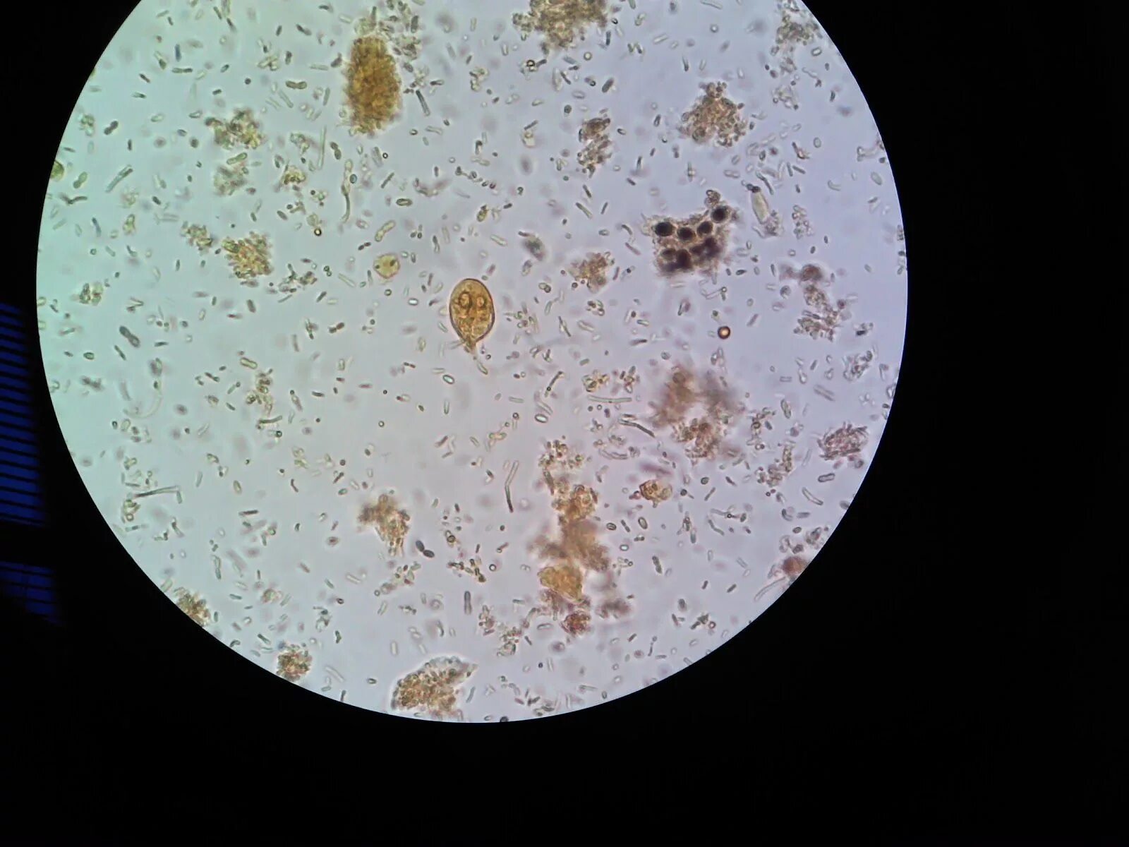 Кальтопроктеин в кале. Цисты лямблии микроскопия. Цисты лямблий микроскопия кала. Цисты лямблий под микроскопом.