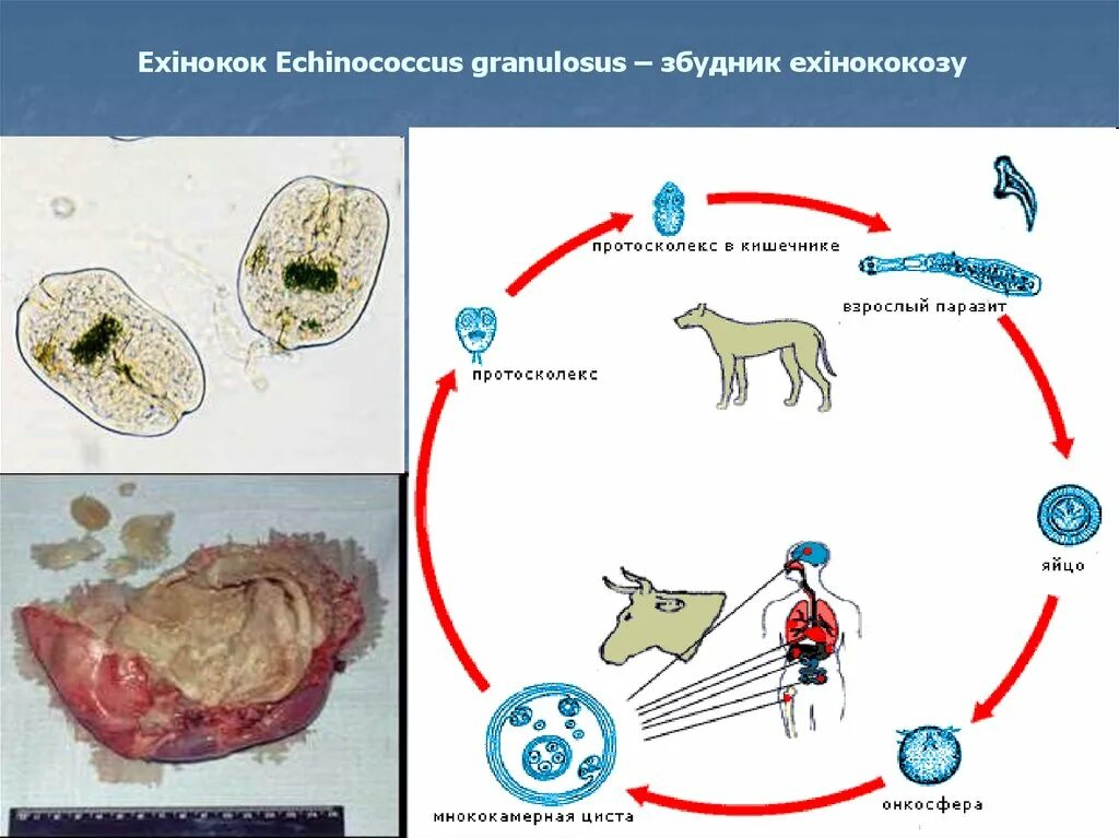 Онкосфера эхинококка. Ленточного гельминта эхинококка. Echinococcus granulosus жизненный цикл.
