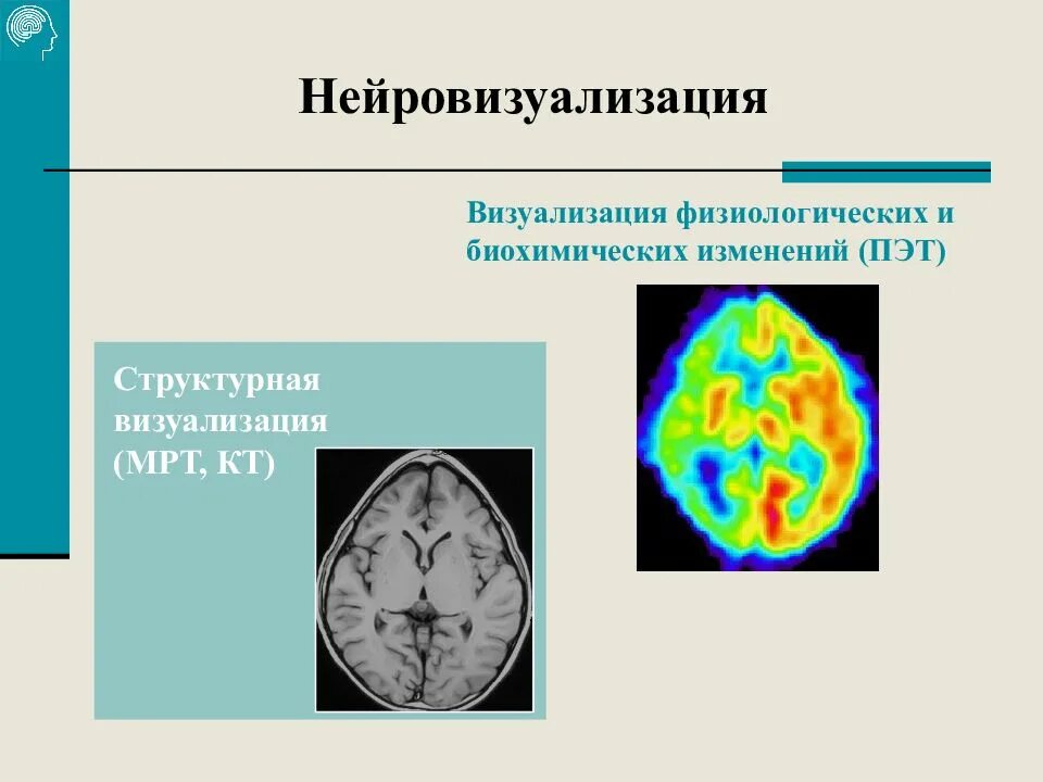 Институт головного мозга санкт. Институт головного мозга Бехтеревой сайт. Нейровизуализация мозга. Нейровизуализация мрт. ПЭТ Нейровизуализация.