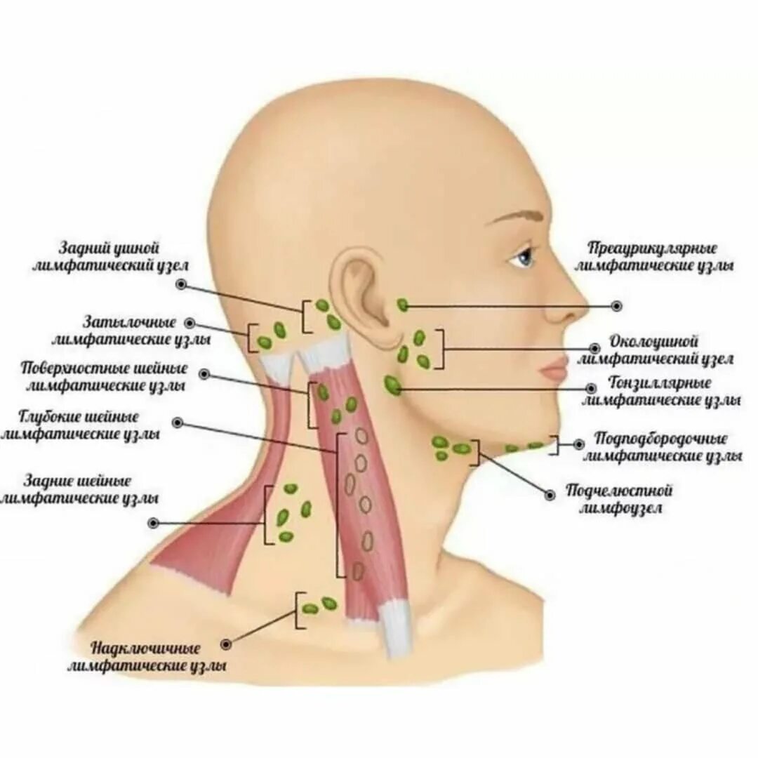 Как узнать лимфоузел. Лимфаденит подчелюстных лимфатических узлов. Латеральные шейные лимфатические узлы. Подчелюстные лимфатические узлы анатомия. Увеличенные лимфатические узлы у детей.