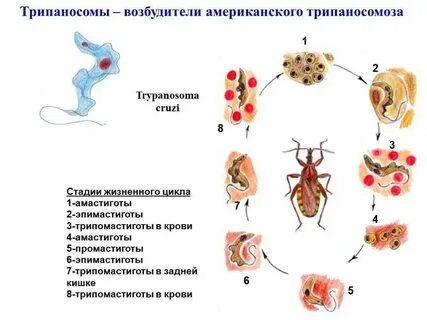 Трипаносомоз