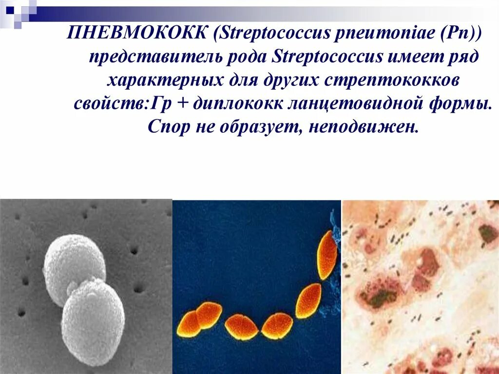 Стрептококки представители. Streptococcus pneumoniae (пневмококк). Пневмококки форма бактерии. Стафилококки стрептококки пневмококки.