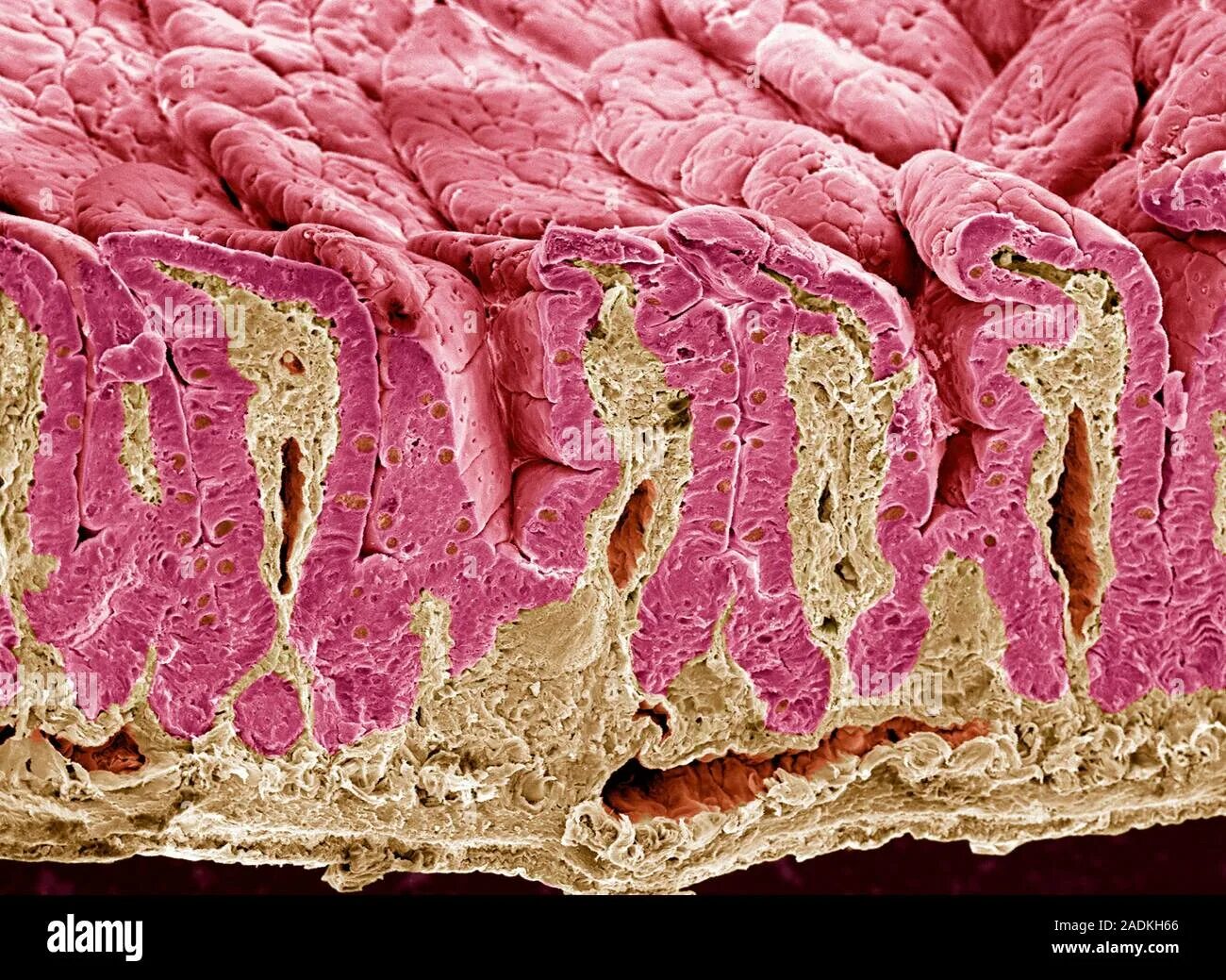 Кишечная Ворсинка гистология. Кишечные ворсинки микрофотография. Кишечник под микроскопом. Тонкий кишечник под микроскопом. Внутренняя поверхность кишечника