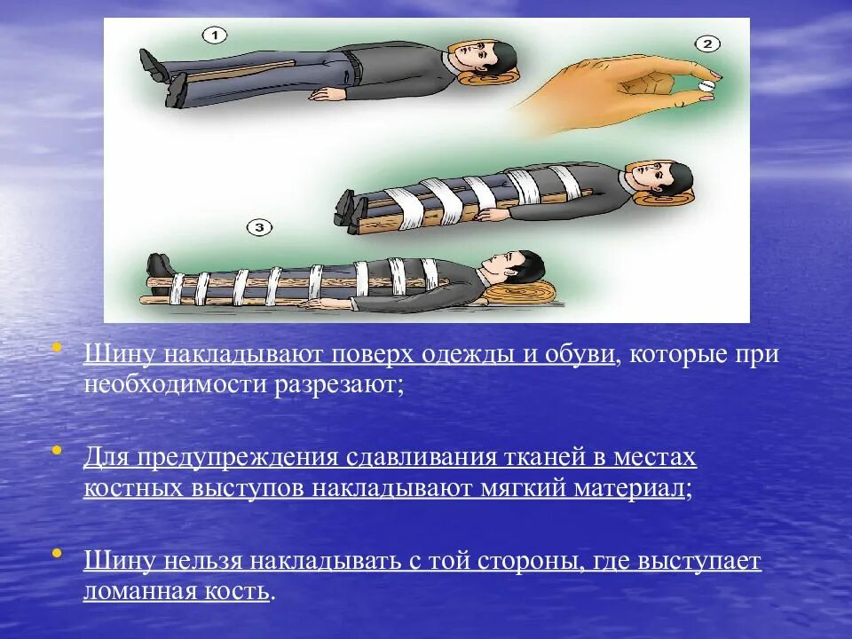 Доврачебная помощь при переломах вывихах. Доврачебная помощь при переломах вывихах