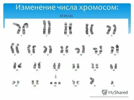 Изменения хромосом