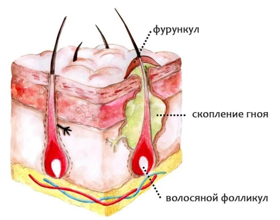 Почему появляется. Почему появляется