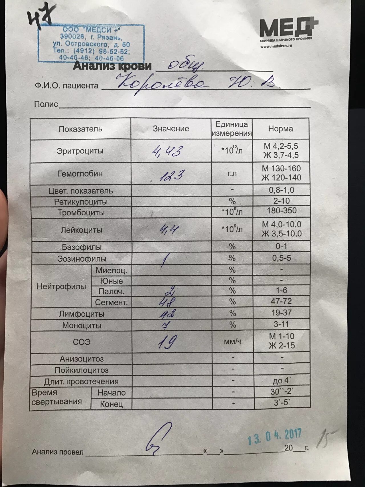 Характерные изменения при атипичной пневмонии в оак. Характерные изменения при атипичной пневмонии в оак