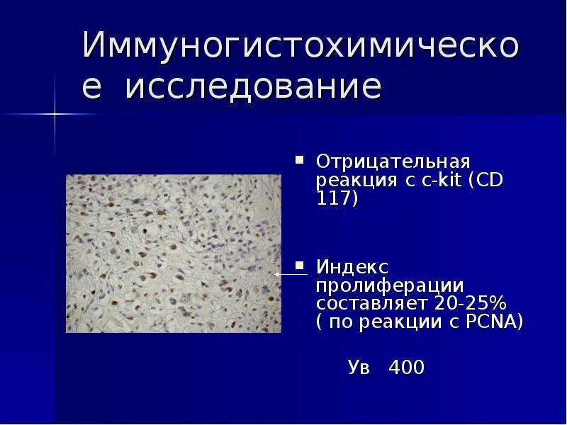 Игх маркеры. Иммуногистохимическое исследование. Иммуногистохимическое исследование опухоли. ИГХ анализ. Иммуногистохимические методы исследования.