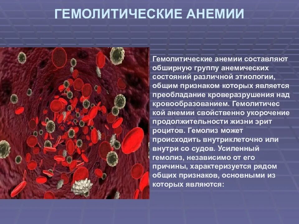 Иммунная анемия. Аутоиммунная гемолитическая анемия картина крови. Картина крови при гемолитической анемии характеризуется. Несфероцитарная гемолитическая анемия. Костный мозг при гемолитической анемии.