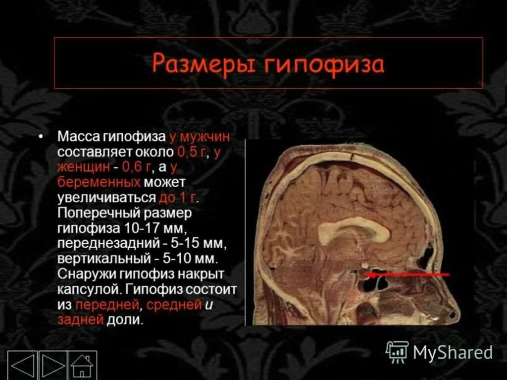 Гипофиз у мужчин. Вертикальный размер гипофиза головного мозга норма. Мрт гипофиза норма. Толщина гипофиза в норме. Нормальные Размеры гипофиза на мрт.