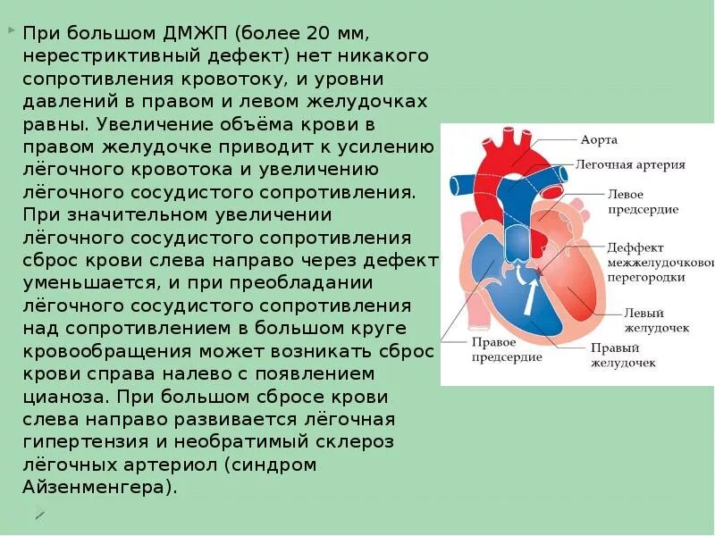 Какая кровь в левом желудочке сердца. Дефект межжелудочковой перегородки давление. Врожденный порок сердца дефект межжелудочной перегородки. Порог сердца межжелудочковая перегородка.
