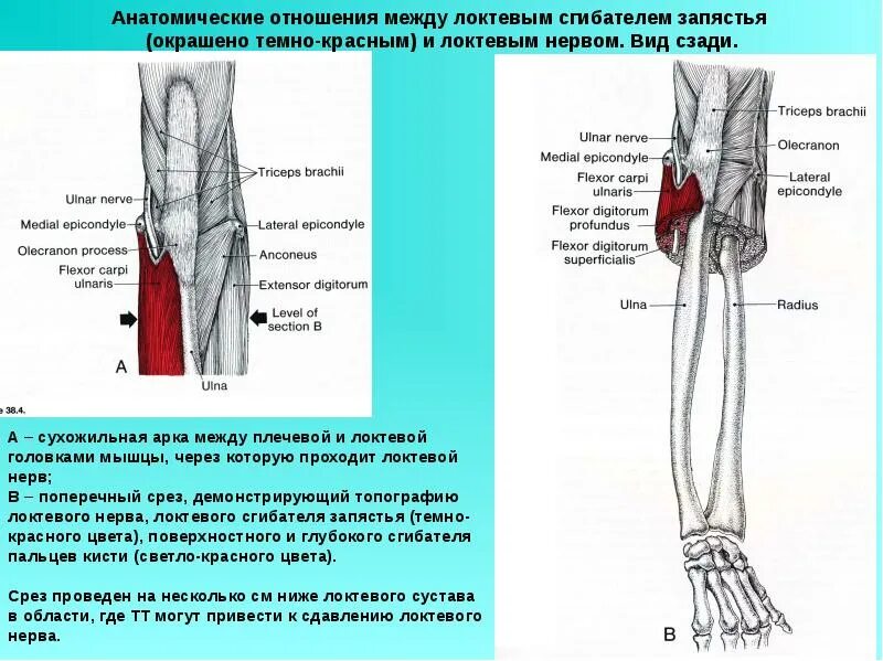 Компрессионная нейропатия локтевого нерва. Кубитальный канал компрессия. Кубитальный туннельный синдром локтевого нерва. Анатомия локтевого нерва в локтевом суставе. Какие нервы в локтевом суставе.