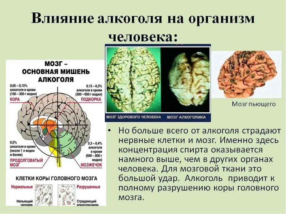 Влияние спирта на головной мозг. Влияние этанола на клетки головного мозга.