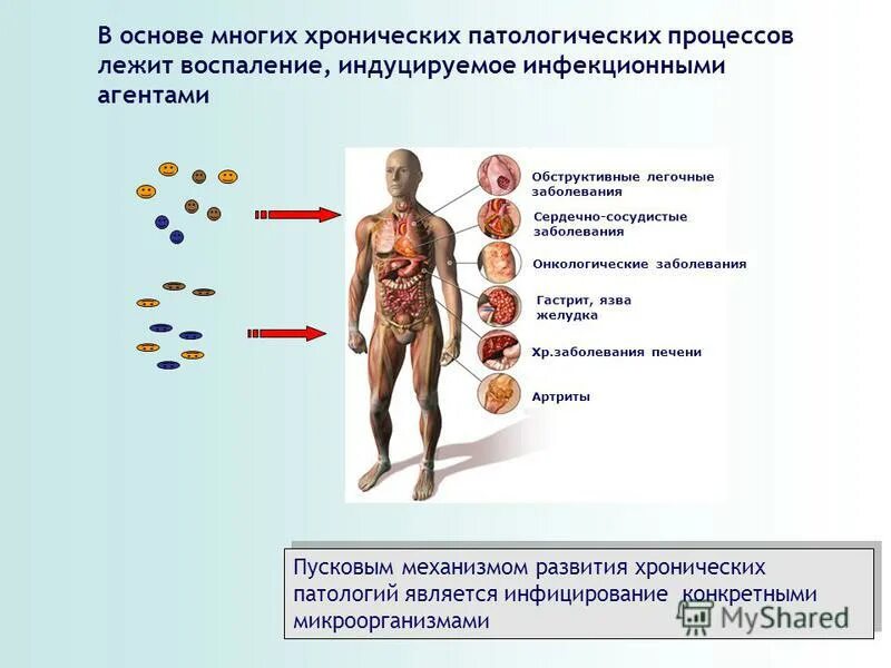 Много хронических заболеваний