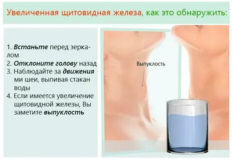 Как узнать симптомы щитовидки у женщин