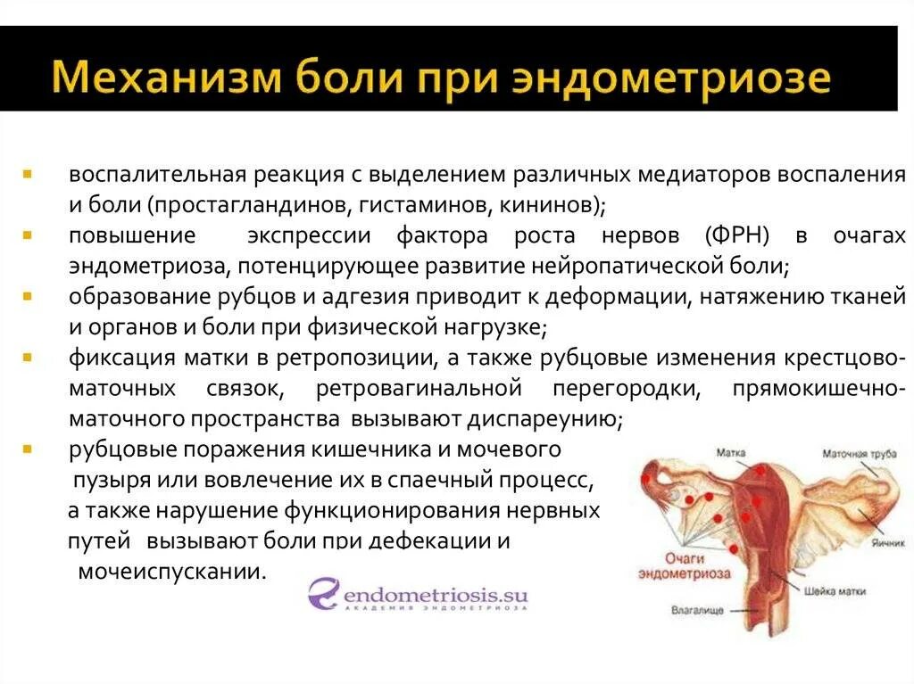 Можно ли вылечить эндометриоз. Механизм боли при эндометриозе. эндометриоз клинические проявления.