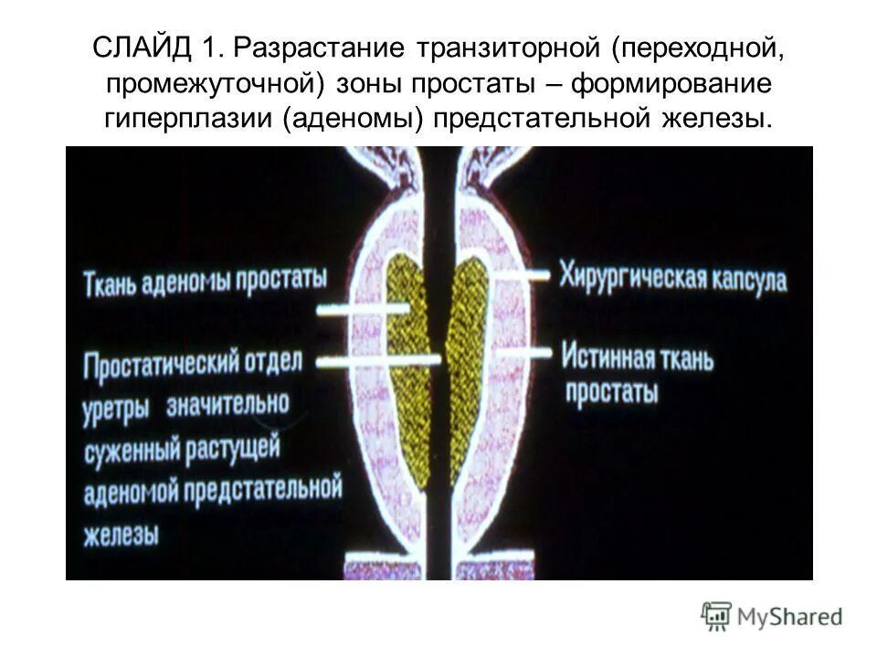 таблетки от аденомы простаты. капсула аденомы. капсула аденомы. простодин капли. омник капсулы 400 мг 10.