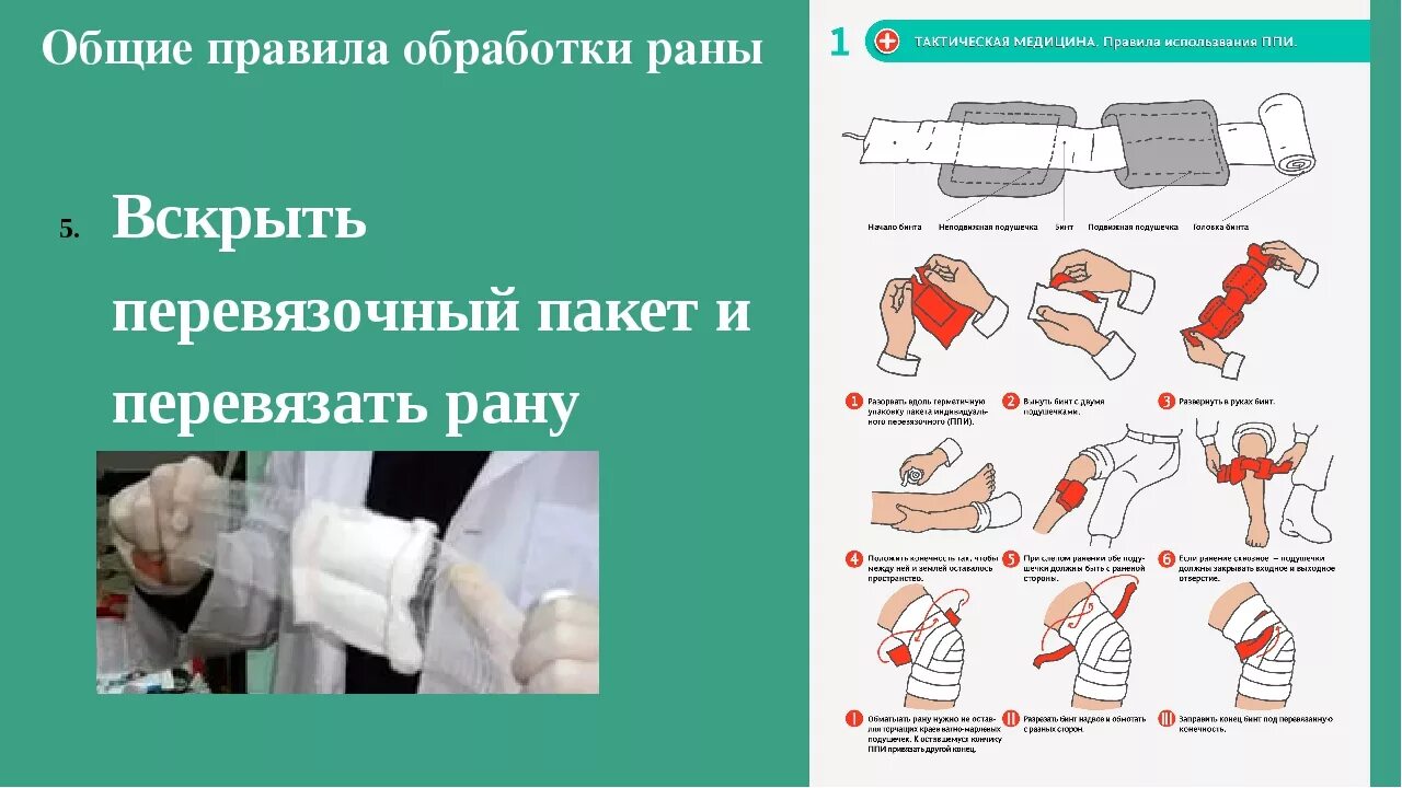 Первая помощь обработка раны. Обработка резаной раны. Перевязывать форум