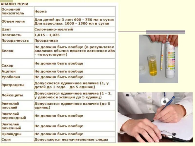 Почему капает моча. Анализ мочи. Исследование ацетона в моче. Общий анализ мочи. Анализ мочи на ацетон.