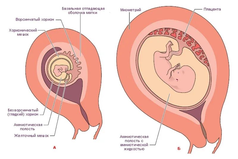 Отслойка хориона на ранних сроках. Хорион плацента локализация передняя стенка матки. Плацента это детское место зародыш плод. Плацента плодные оболочки пуповина.