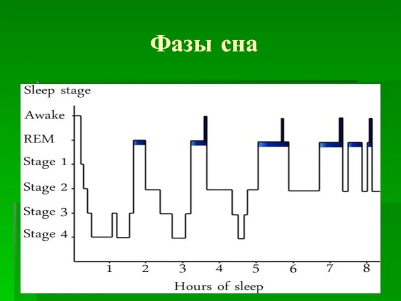 Фазы сна. Фазы сна график. Стадии сна диаграмма. Чередование фаз сна.