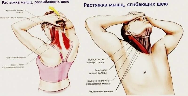 Как расслабить мышцы шеи. Растяжка мышц разгибающих шею. Как расслабить мыщцышеи. Растяжка ременной мышцы шеи. Можно греть мышцы