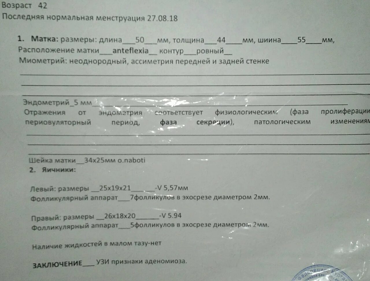 Аденомиоз УЗИ заключение. Заключение УЗИ при аденомиозе. Аденомиоз по УЗИ заключение. УЗИ признаки аденомиоза. Эхопризнаки аденомиоза что это