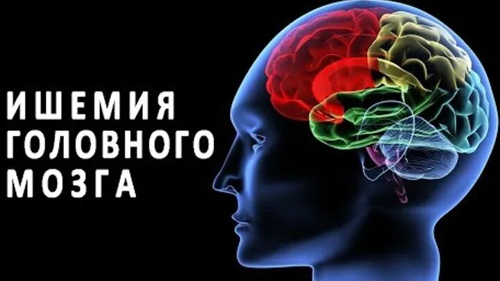 Ишемия мозга. Хроническая ишемия мозга.