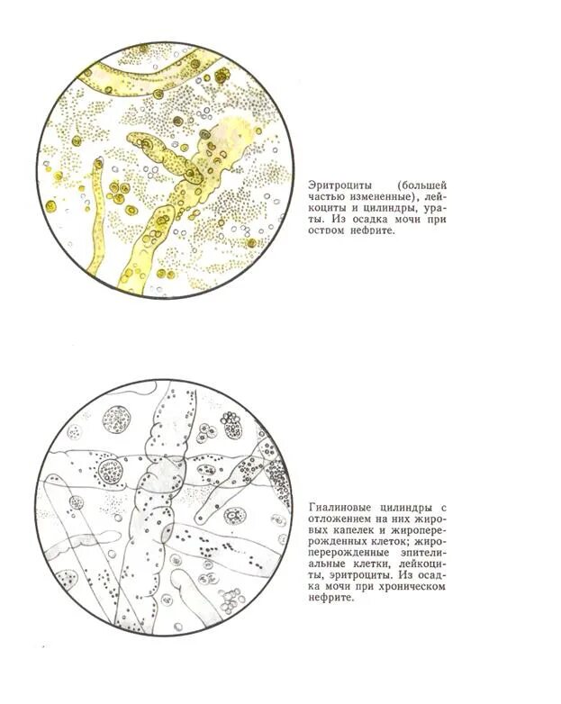 ФСВОК микроскопия осадка мочи. Мочевой атлас микроскопии осадков мочи. Измененные эритроциты в осадке мочи. Эритроциты в осадке мочи.