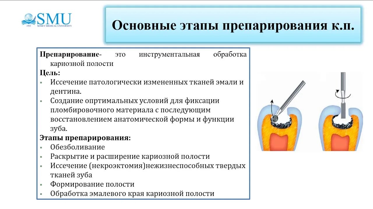 Ошибки при препарировании кариозных полостей. Этапы препарирования кариеса. этапы препарирования по блэку. препарирование кариозной полости. этапы препарирования кариозных полостей.