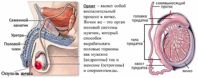 Уплотнение внизу яичка. Воспаление яичка у мужчин. Болит в правом яичке у мужчин