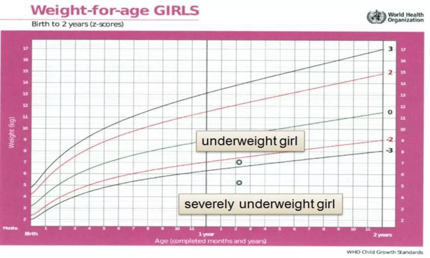 Lighter age. Who Weight for age. Weight for age girls. World Health Organization Weight for age girls. Weight for age girls who.