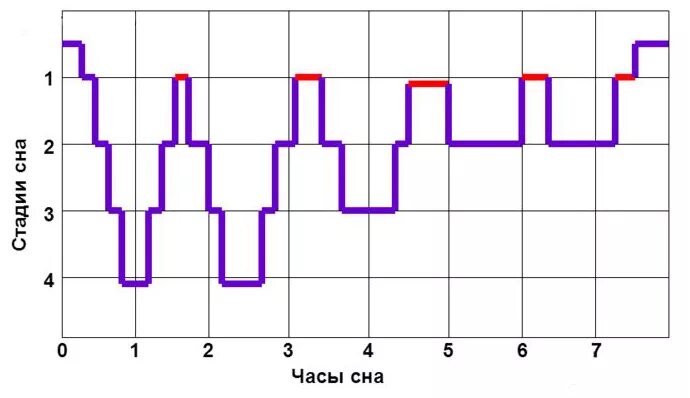 Фазы сна диаграмма. Фазы сна схема. Сон фазы сна. Фазы быстрого сна график.