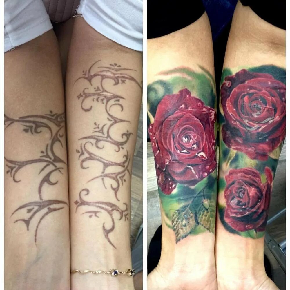 тату на шрамах на руке для девушек. татуировки на шрамах на руке женские. тату для перекрытия шрамов на руке девушке. тату на шрамах на руке для девушек. перекрытие шрамов татуировкой.